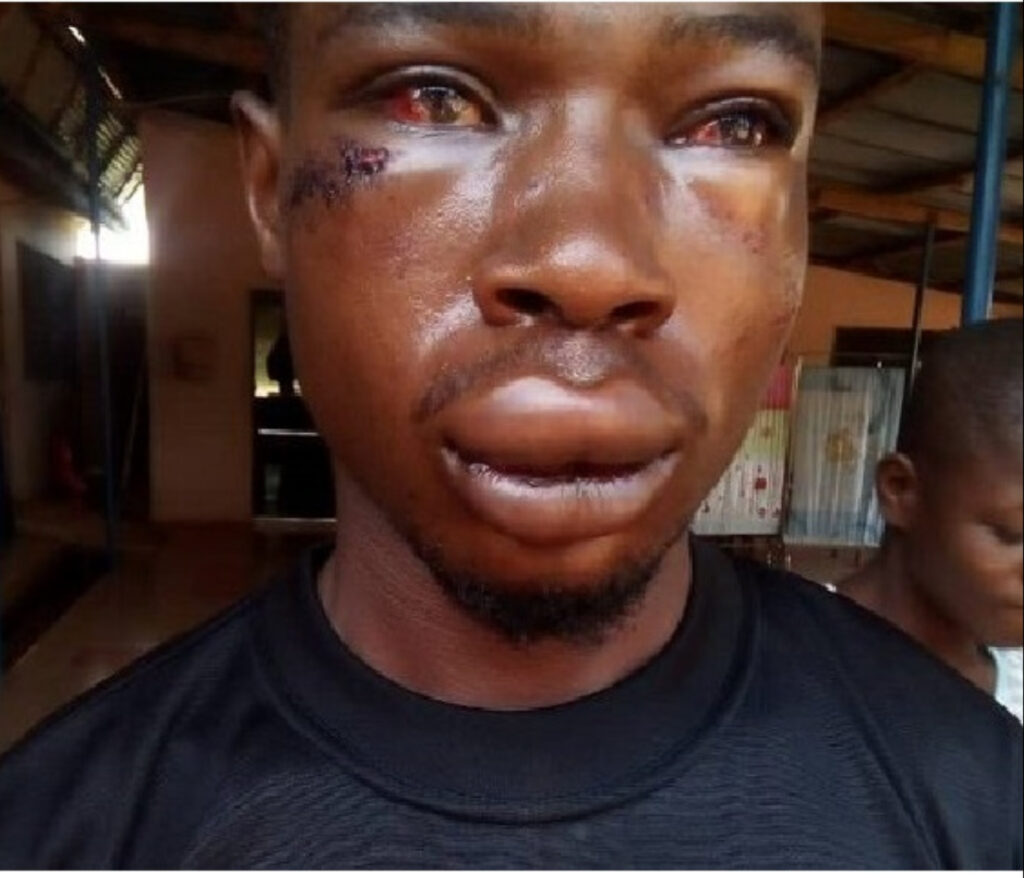 University of Education Student Beaten for Flirting with CID Officer’s Wife